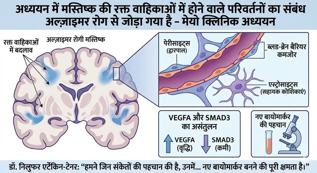 Key link discovered between Alzheimer's and brain blood vessels