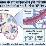 Key link discovered between Alzheimers and brain blood vessels 2