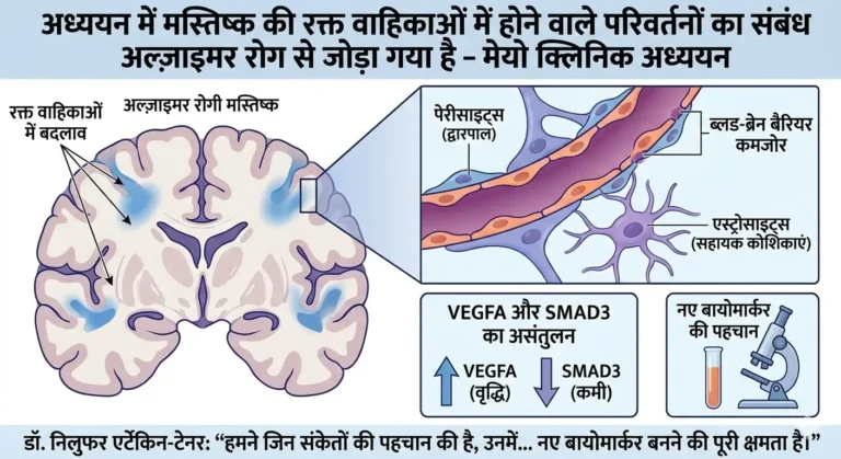Key link discovered between Alzheimers and brain blood vessels 2