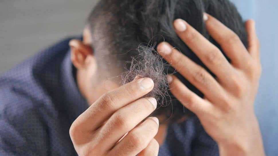 सर्दियों में बालों का झड़ना रोकने के 7 उपाय