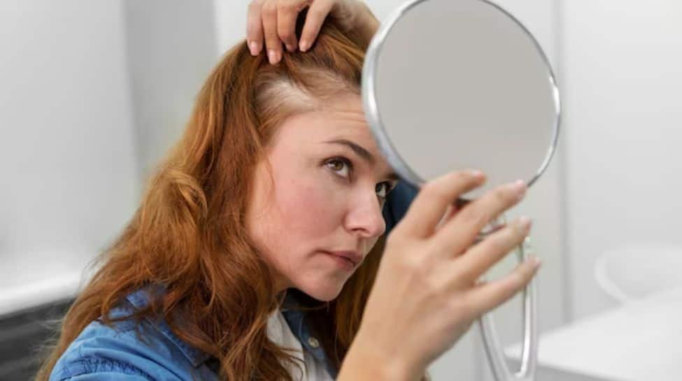 बालों के झड़ने से हैं परेशान? गैर-सर्जिकल विकल्प बनाम बाल प्रत्यारोपण; जानिए सही विकल्प