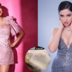 दिव्या खोसला को फिल्म सेट पर चोट लगी है, नेटिज़ेंस उसे एक त्वरित वसूली की कामना करता है