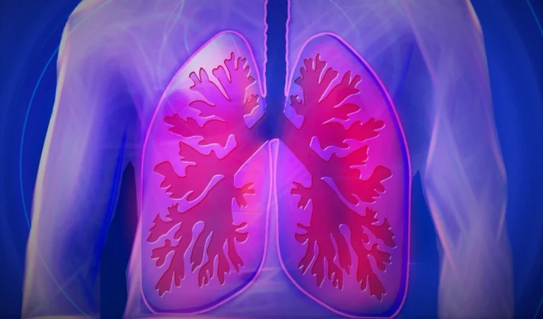 World Tuberculosis Day