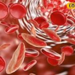 रक्त का कोई नुकसान नहीं है! डॉक्टर ने एनीमिया और आसान उपचार के खतरनाक लक्षणों को समझाया