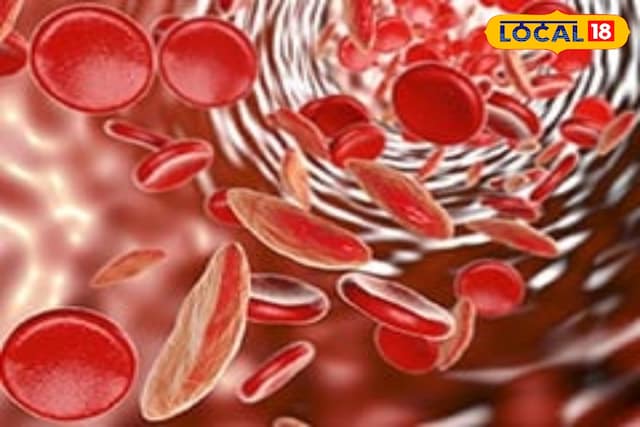 एनीमिया के लक्षण: रक्त का कोई नुकसान नहीं है! डॉक्टर ने एनीमिया और आसान उपचार के खतरनाक लक्षणों को समझाया