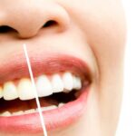 पीले दांतों के मुद्दे से छुटकारा पाना चाहते हैं? अपने दांतों को स्वाभाविक रूप से सफेद करने के लिए इन 5 घरेलू उपचारों का पालन करें