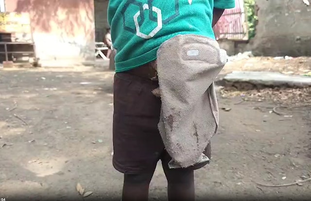 कमर पर लटकते हुए और आंखों में उम्मीद, पिता 4 साल की लड़की द्वारा ठोकर खा रहे हैं, पता है कि क्या मामला है?