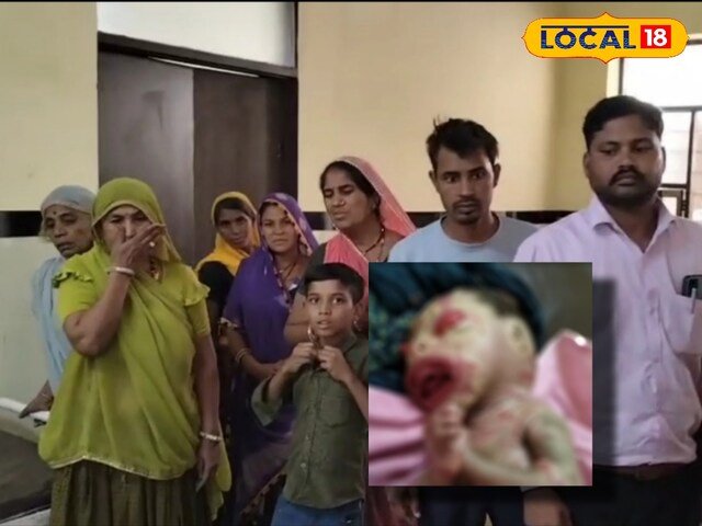 महिला ने एक अनोखे बच्चे को जन्म दिया, डॉक्टरों ने कहा, ऐसे मामले हैं