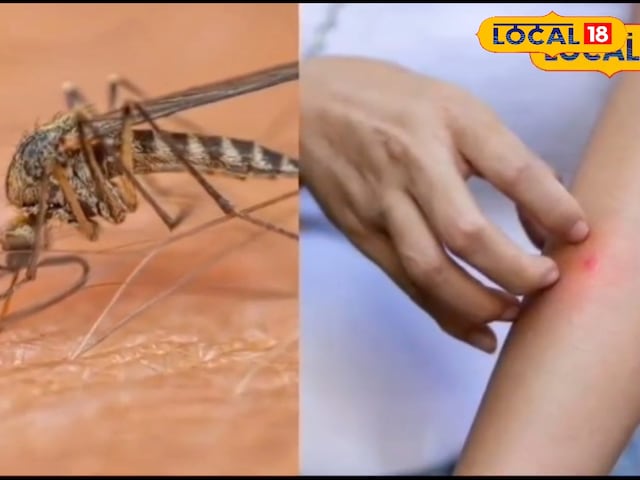 स्वास्थ्य विभाग डेंगू से निपटने के लिए तैयार, समय से पहले पूरी की गई तैयारी