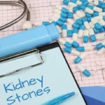 Kidney Stone