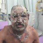 बेटी -इन -इन ने अपने पिता को बनाया था, जो आग का शिकार हुआ, खाने के लिए तर्क के बाद एक भयानक घटना!