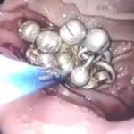 जैसे ही आप पायदान पहनते हैं, जैसे ही वे अल्ट्रासाउंड हो जाते हैं, जैसे ही बेटी के पेट में आवास का दर्द होता है!