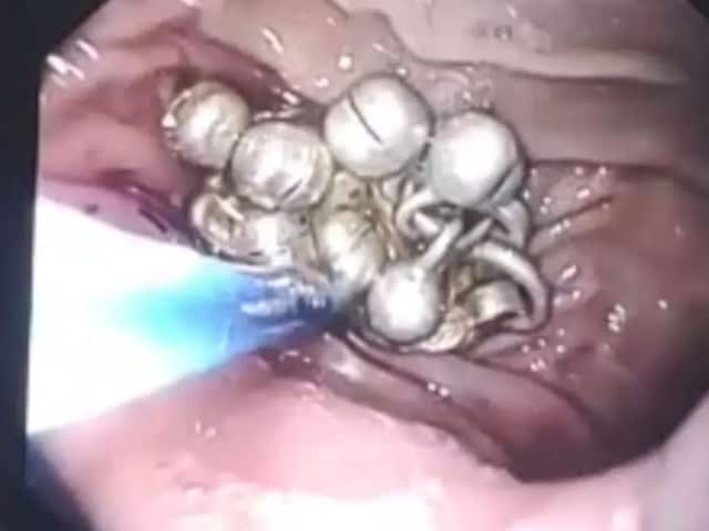 मां ने एक शौक के साथ बेटी को एक पायल पहना, अगले दिन पेट में भयंकर दर्द, जैसे ही वे अल्ट्रासाउंड हो गए, होश उड़ गए!