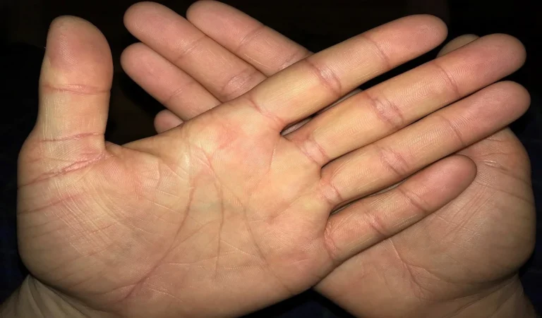 Bhagya Rekha In Hand