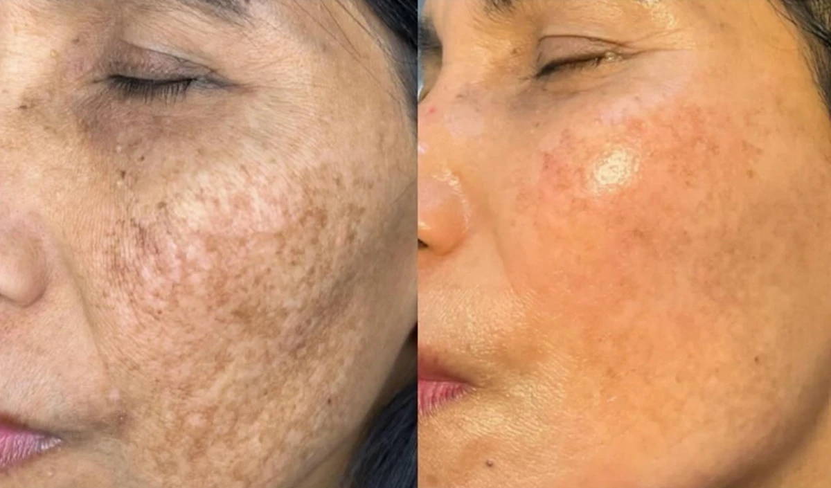 स्वास्थ्य युक्तियाँ: कोज़लान की कमी के कारण जल्द ही वृद्धावस्था आती है, यह जानती है कि इसे कैसे दूर किया जाए