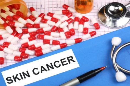 skin cancer