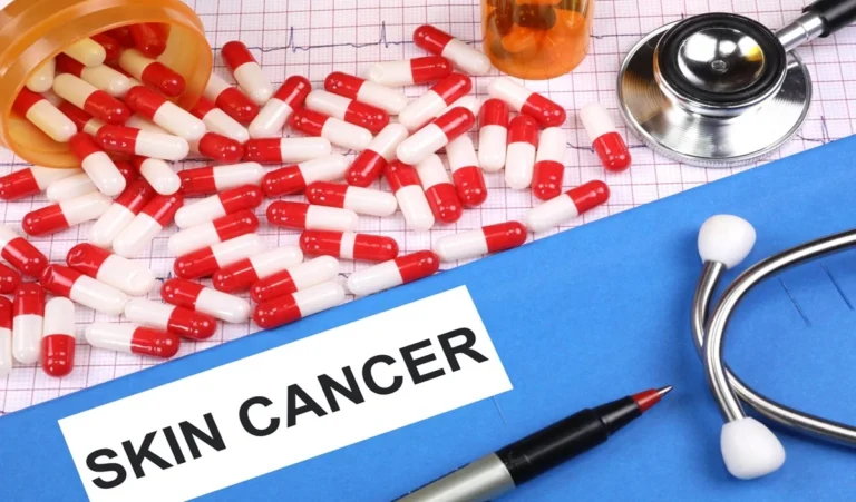 skin cancer