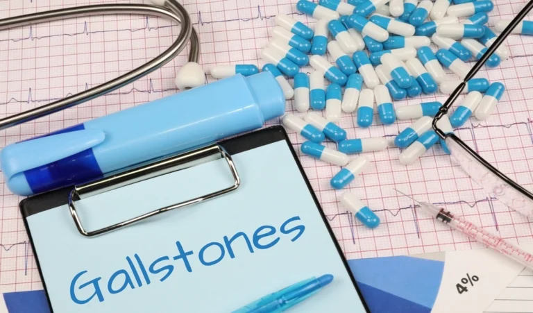 Gallstones Symptoms