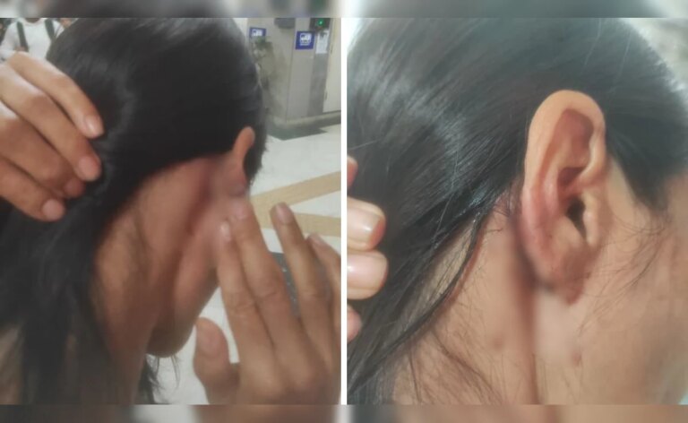 दिल्ली के पार्क में छेड़छाड़ का विरोध करने पर मणिपुर की महिला को बेल्ट से पीटा गया