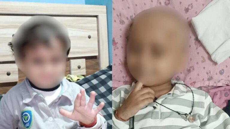 एम्स भोपाल में नर्स के फॉर्मेलिन इंजेक्शन से कैंसर के 3 मरीजों की मौत