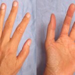 Nail Palmistry