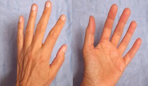 Nail Palmistry