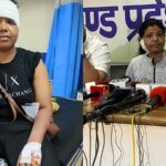 "कान लगभग कट गया था": महिला ने सीजेपी विरोध प्रदर्शन के दौरान पुलिस की कार्रवाई का वर्णन किया