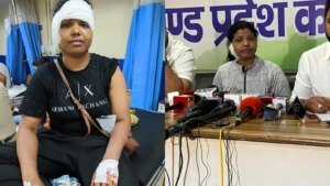 "कान लगभग कट गया था": महिला ने सीजेपी विरोध प्रदर्शन के दौरान पुलिस की कार्रवाई का वर्णन किया