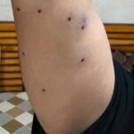 प्रदर्शनकारियों पर पैलेट गन का इस्तेमाल करने वाली दंगारोधी पुलिस की पहचान, सीआरपीएफ जांच