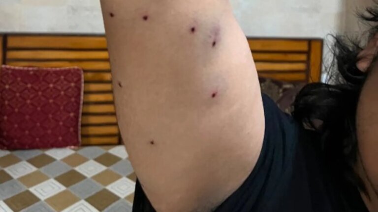 प्रदर्शनकारियों पर पैलेट गन का इस्तेमाल करने वाली दंगारोधी पुलिस की पहचान, सीआरपीएफ जांच