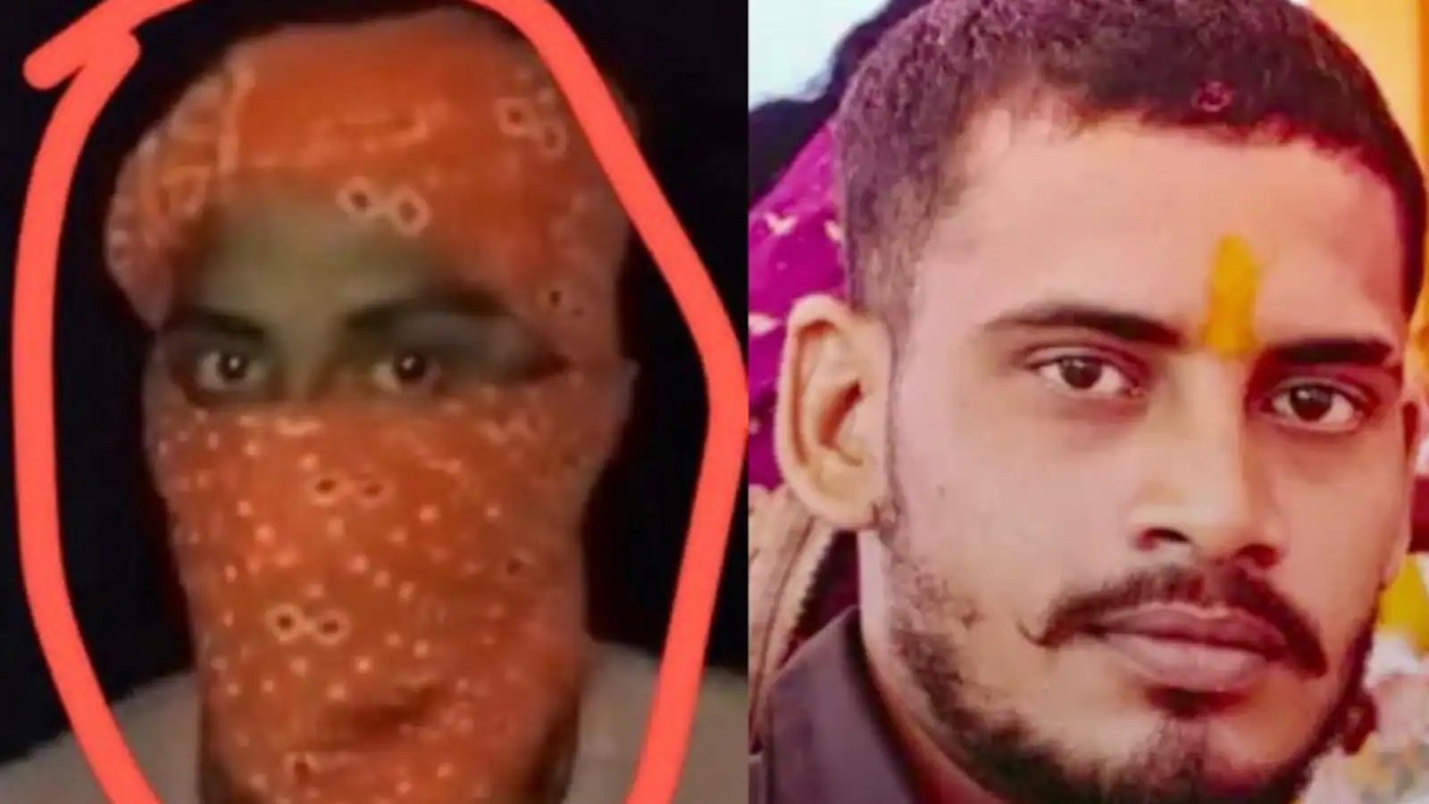 बिहार में मुठभेड़ के दौरान मुख्य आरोपी को गोली लगी, अस्पताल ले जाया गया