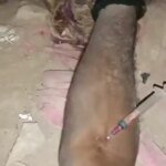 पंजाब के एक व्यक्ति का शव उसके हाथ में सिरिंज फंसा हुआ मिला, आशंका है कि उसने नशे का ओवरडोज़ ले लिया है